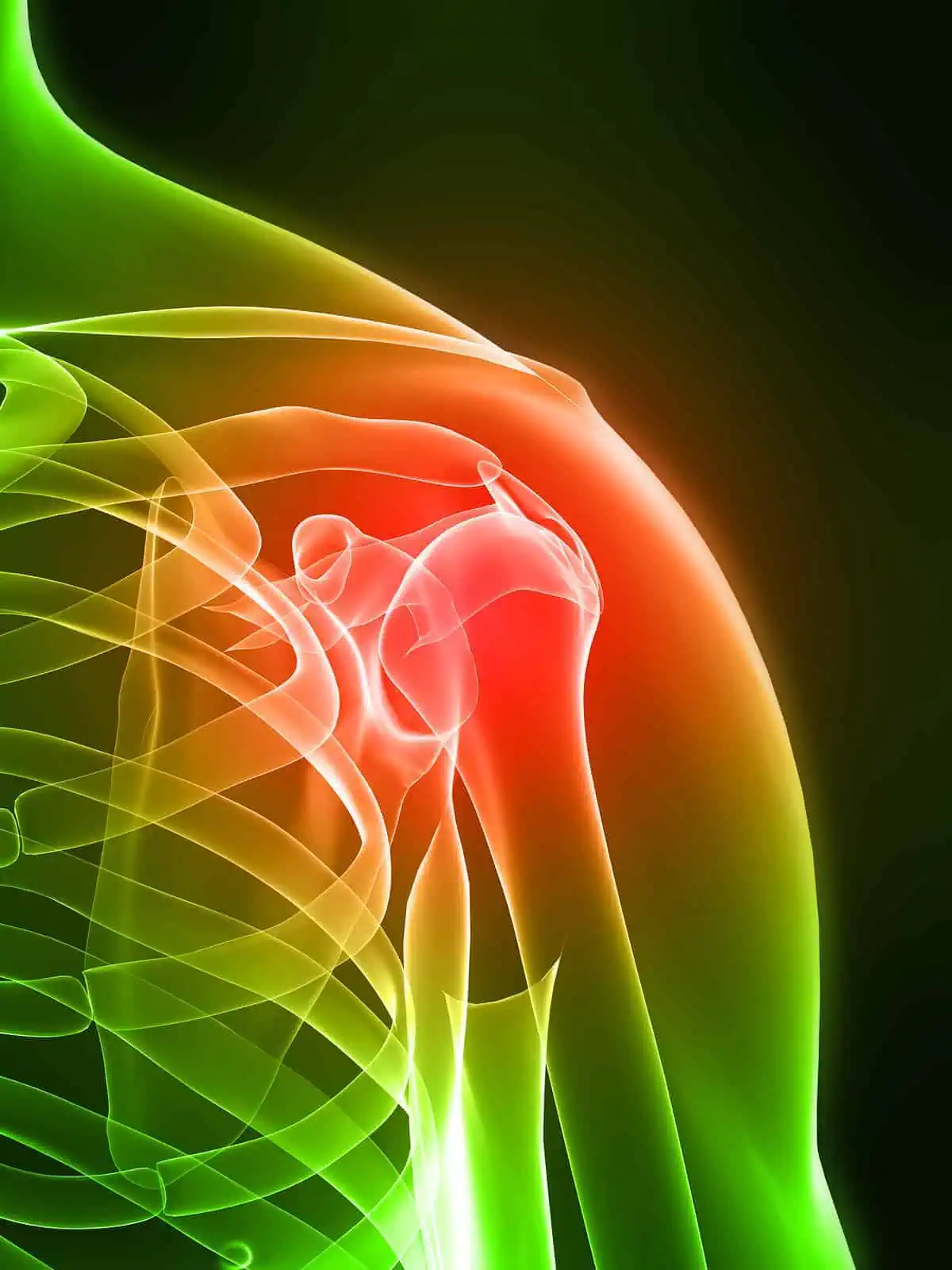 X-ray view of a red inflamed shoulder joint