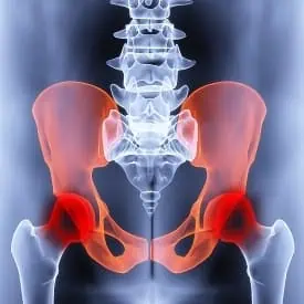 X-ray image of a red inflamed pelvis